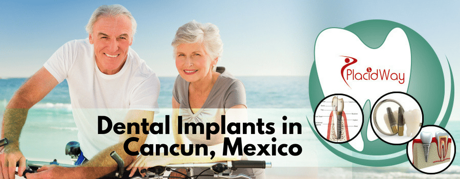 Dental Implants in Cancun Mexico